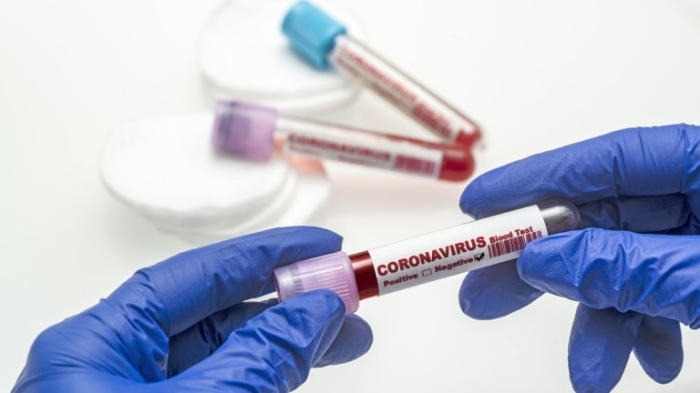 397 са новите случаи на коронавирус у нас